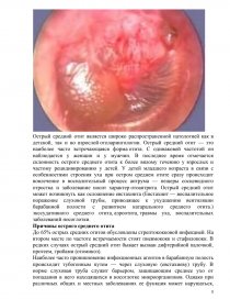 Реферат: Отит его стадии