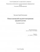 Поиск аномалий на рентгенограммах грудной клетки